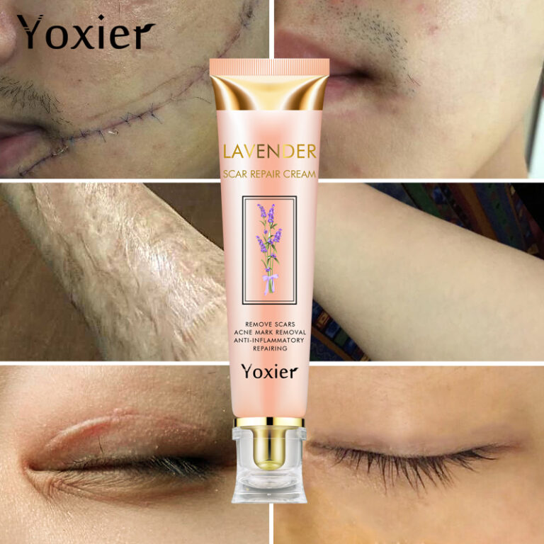 Yoxier Lavender Scar Repair KM Goods